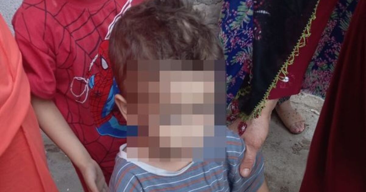 Bunu yapan insan olamaz! Ayaklarında plastik kelepçe ile kurtarıldı