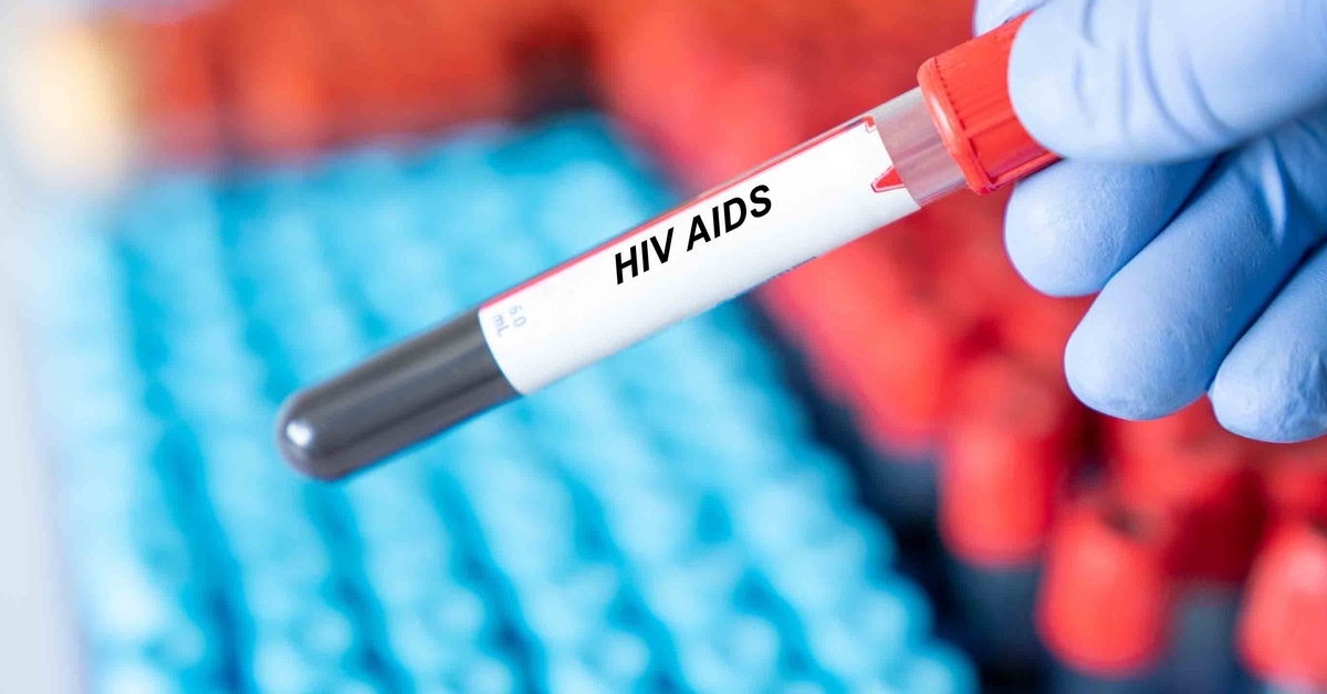 BM’den “AIDS Bir Kavşakta” vurgusu